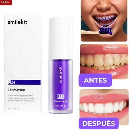 Blanqueador Dental Morada V34, ¡Sonrisa Brillante!